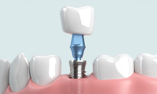しっかり噛めると健康寿命が延びる！？