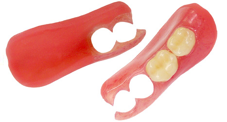 部分入れ歯の金具使用なし！