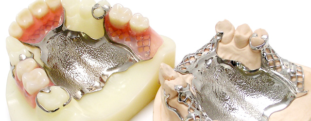金属床入れ歯で入れ歯を薄く！