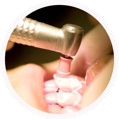 歯のクリーニング