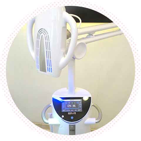 歯のホワイトニング