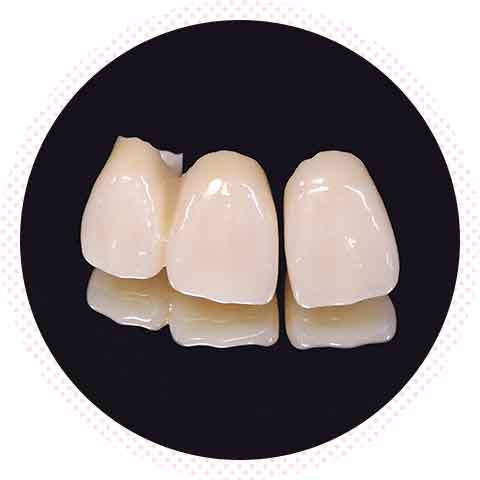 セラミック治療