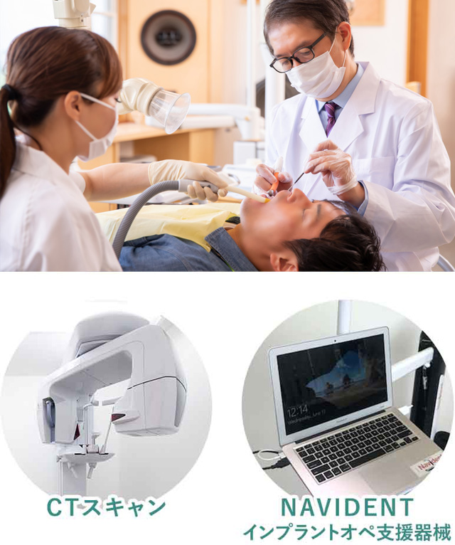 進歩するインプラント治療