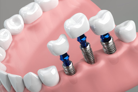 取り外しが不要で快適