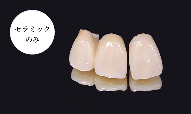 オールセラミック