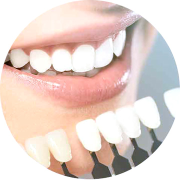 セラミック治療